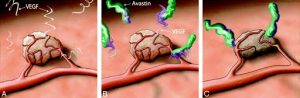 avastin